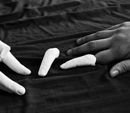 2 Hands, one real one, one out of plaster